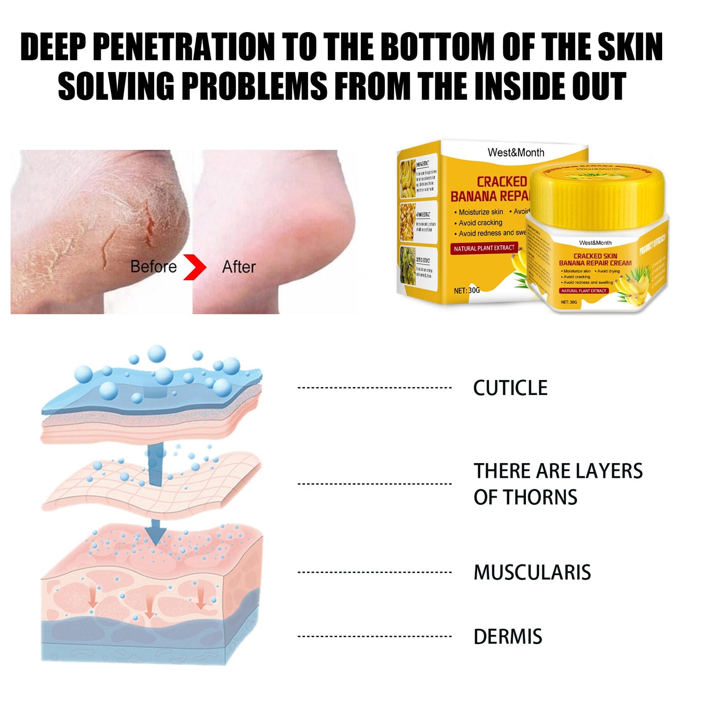 Cracked Skin Banana Repair Cream, Nourishing And Moisturizing Foot Repair Cream To Soften Exfoliation And Remove Dead Skin Calluses - Korvel