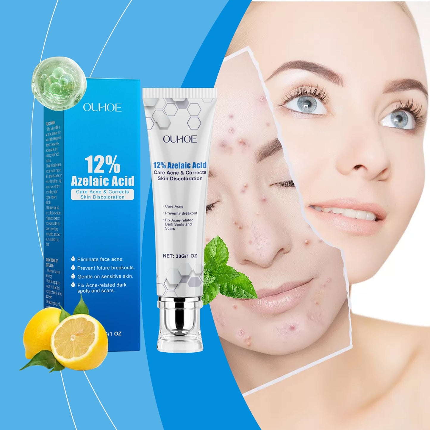 Azelaic Acid Acne Cream Gently Nourishes And Moisturizes Skin And Balances Oil And AcneOuhoe Azelaic Acid Acne Cream Gently Nourishes And Moisturizes Skin And Balances Oil And Acne - Korvel