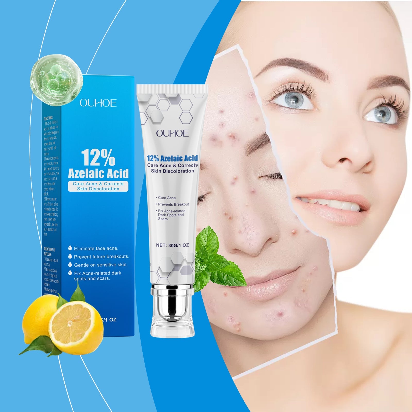 Azelaic Acid Acne Cream Gently Nourishes And Moisturizes Skin And Balances Oil And AcneOuhoe Azelaic Acid Acne Cream Gently Nourishes And Moisturizes Skin And Balances Oil And Acne - Korvel