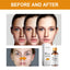 Dark Spot Serum, Hydrating Moist Firming Facial Skin Repair Skin Dark Bright Skin Care Essence - Korvel