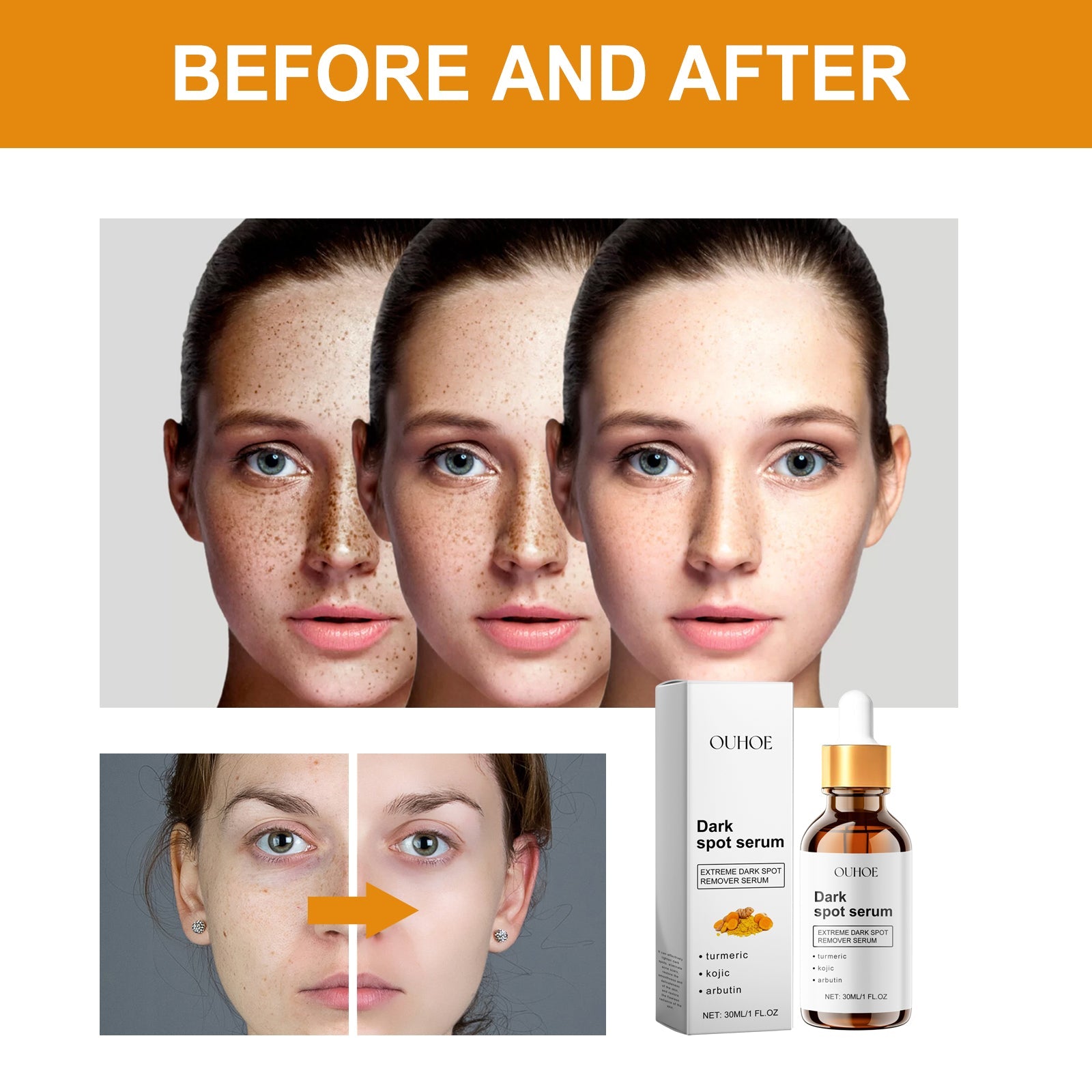 Dark Spot Serum, Hydrating Moist Firming Facial Skin Repair Skin Dark Bright Skin Care Essence - Korvel