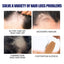 Men's Dense Hair Foam Machine, Repair Hair Root Follicle Men's Hair Thick Moisturizing Foam - Korvel