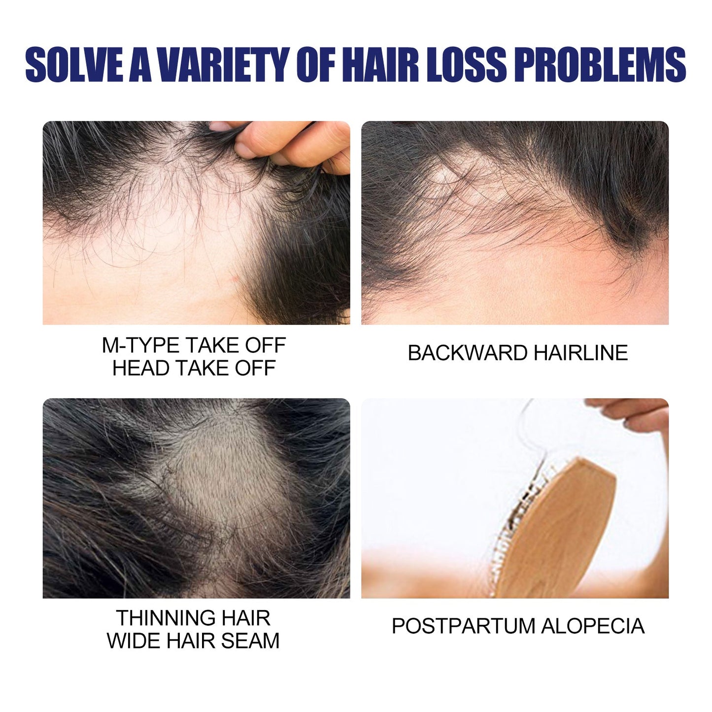 Men's Dense Hair Foam Machine, Repair Hair Root Follicle Men's Hair Thick Moisturizing Foam - Korvel