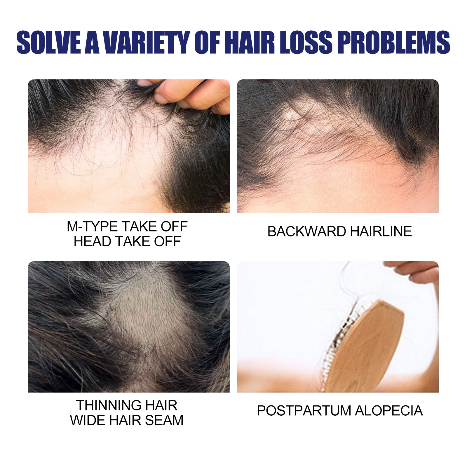 Men's Dense Hair Foam Machine, Repair Hair Root Follicle Men's Hair Thick Moisturizing Foam - Korvel