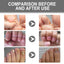 Nail Care Cream, Light Armor Repair Bad Ingrown Nail Nails Brothers Nail Thickening A Ditch Nursing - Korvel