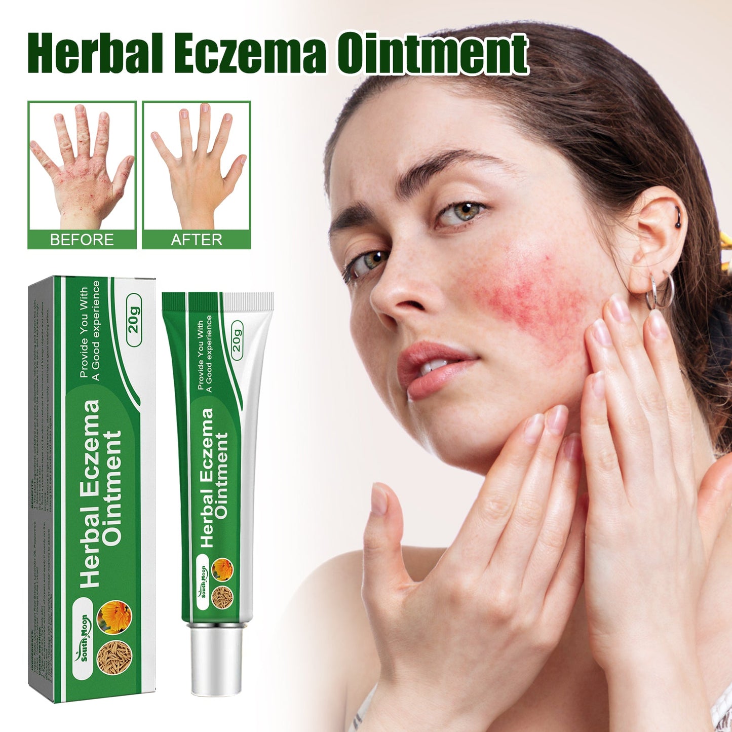 Onguent Herbal de Soulagement de l'Eczéma pour les Mains et les Pieds