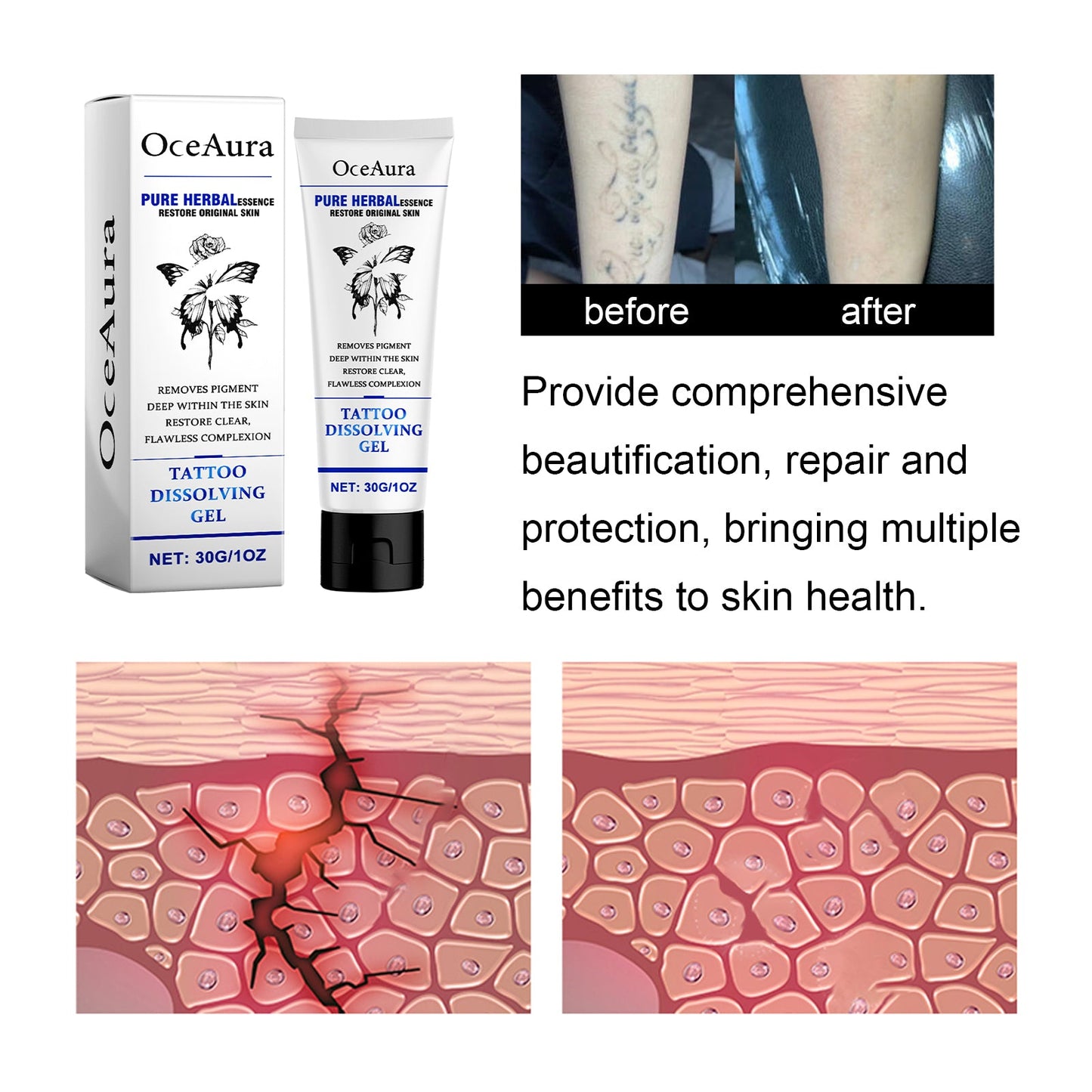 Gel de Cuidado de Tatuajes Premium para Iluminación y Reparación de la Piel