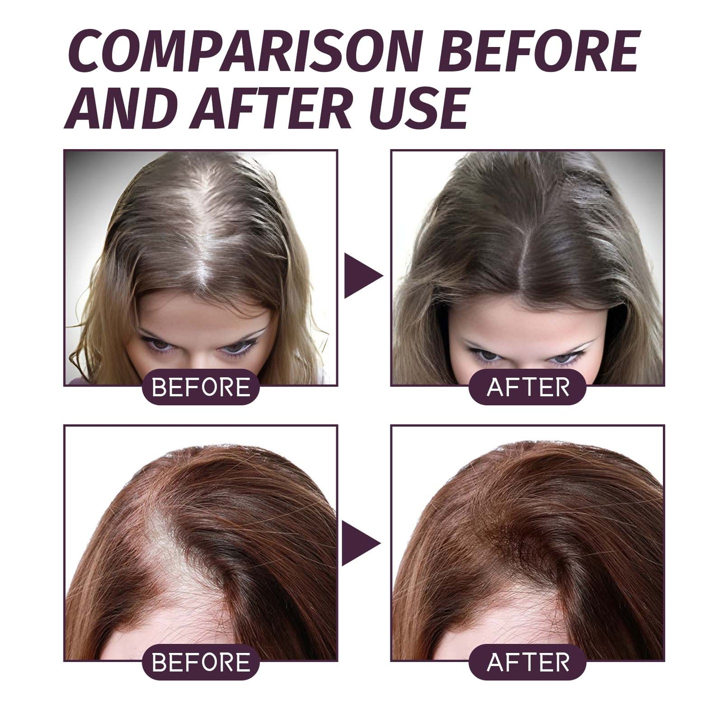 Volumizing And Dense Hair Spray, Repair Dry Hair, Strengthen Hair Nourishing And Volumizing Hair Treatment Spray - Korvel