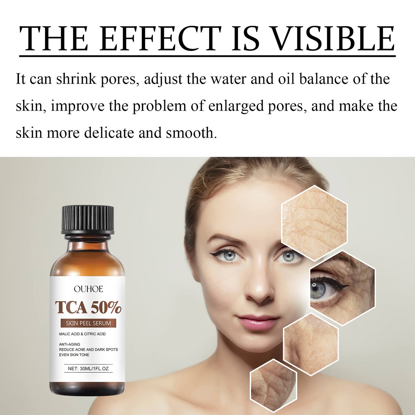 TCA 50 Skin Peel Serum, It Moisturizes Brightens The Firming Skin Fade Wrinkles This Skin Cream - Korvel