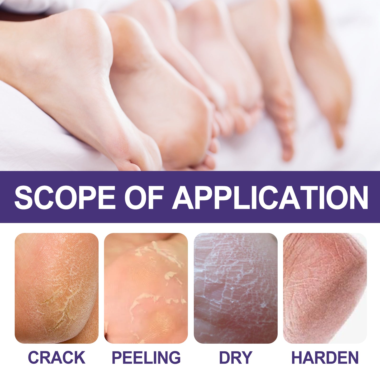 Skin Care Cream, Autumn And Winter Skin Anti-Crack Peeling Exfoliating Moisturizing Soft Moisturizing Body Cream - Korvel