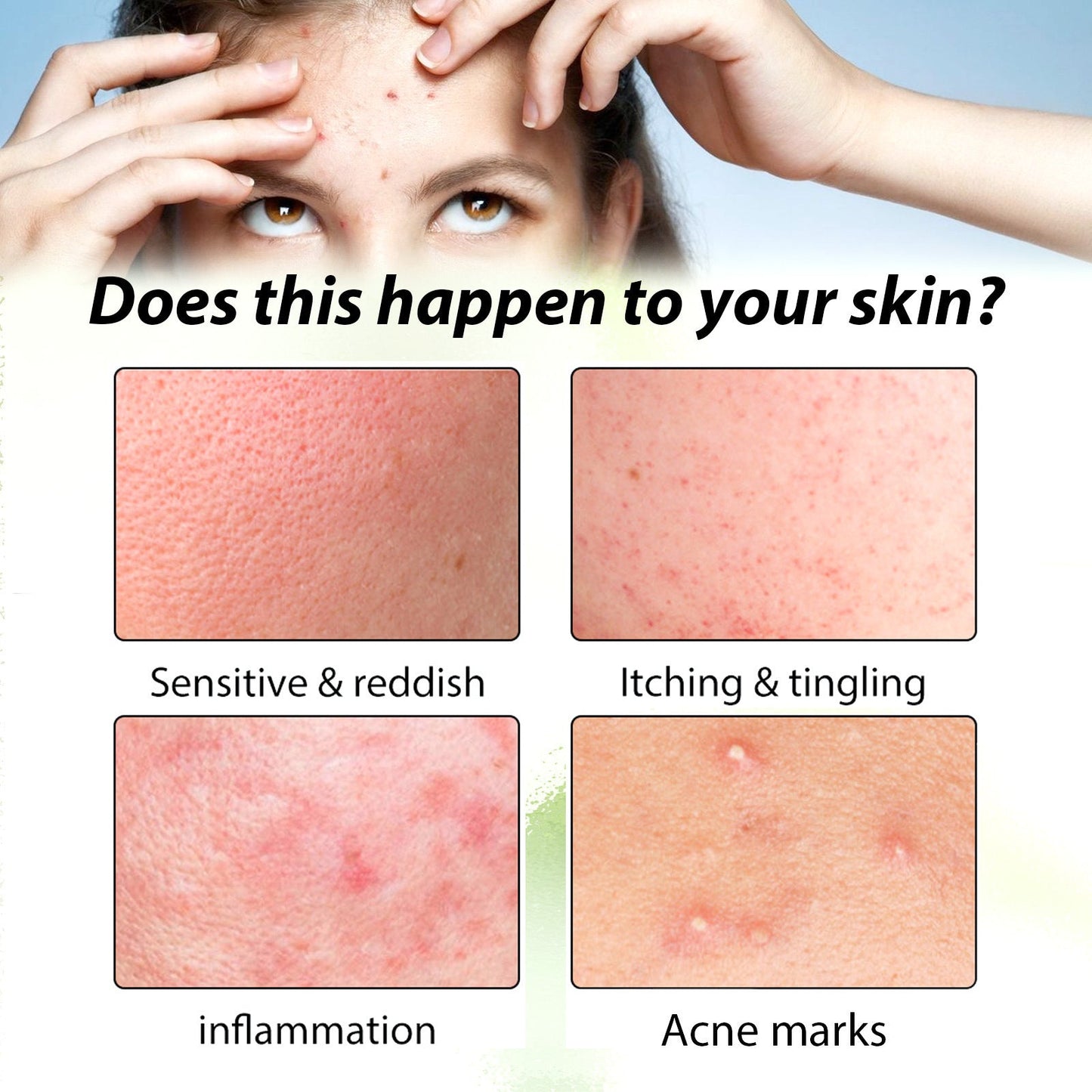Premium Herbal Acne Serum for Clear Skin