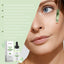 Azelaic Acid Facial Essence Moisturizes And Improves The Skin For Blackheads And Acne - Korvel