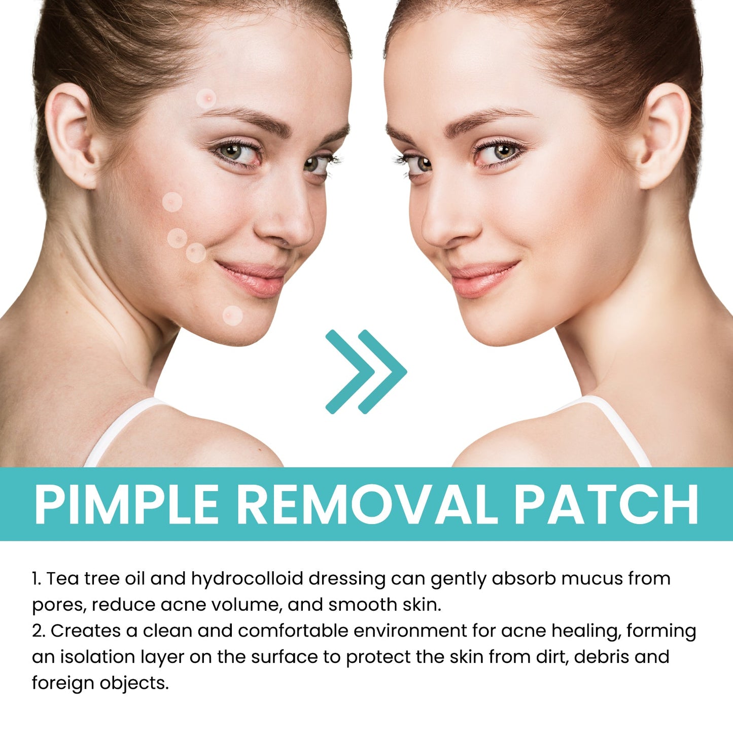 Acne Patch Repair Acne Patch Pore-Cleansing Invisible Breathable Concealer Waterproof Acne Patch - Korvel
