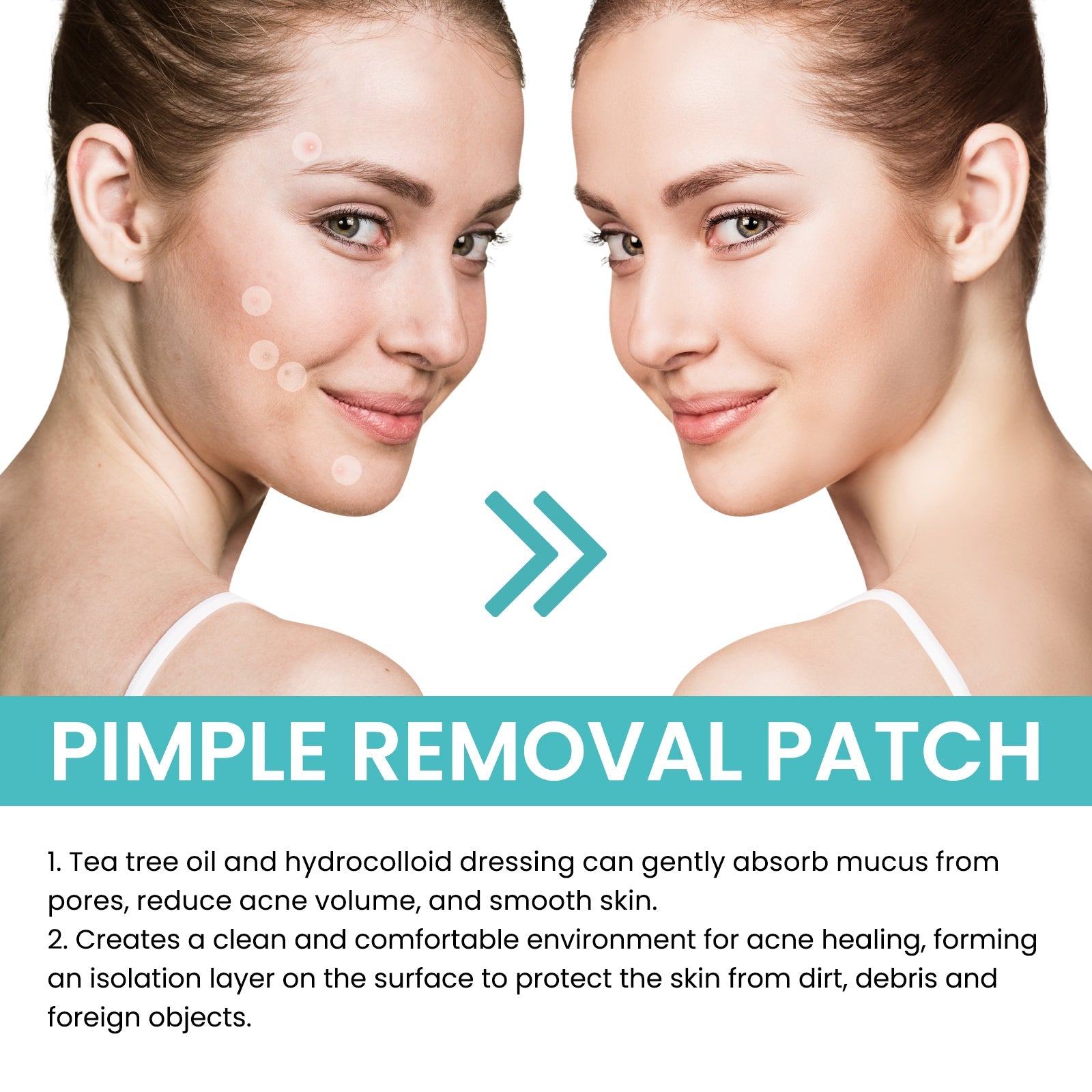 Acne Patch Repair Acne Patch Pore-Cleansing Invisible Breathable Concealer Waterproof Acne Patch - Korvel