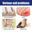 Nail Repair Solution Gentle Clean, Moisturize, Moisturize And Nourish Nails And Nails - Korvel