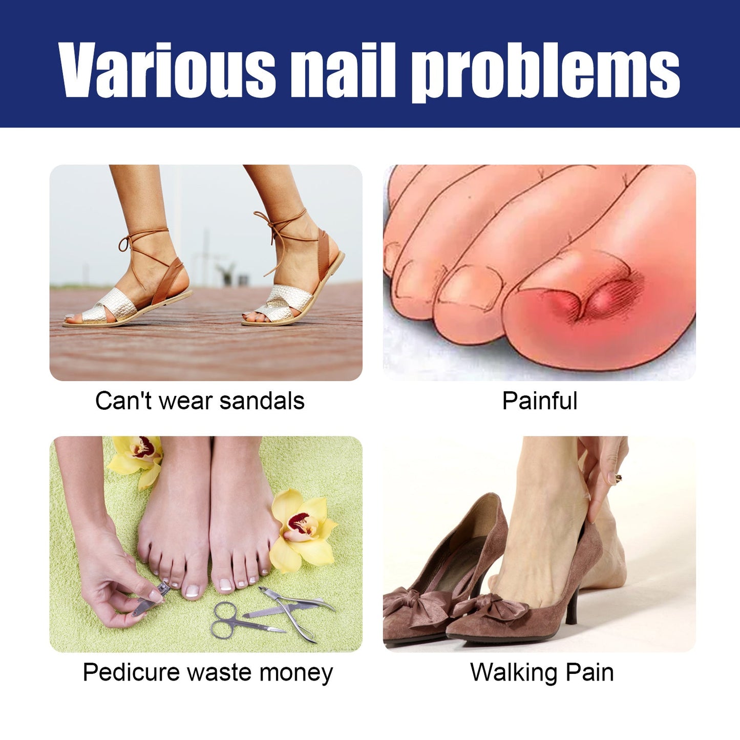 Nail Repair Solution Gentle Clean, Moisturize, Moisturize And Nourish Nails And Nails - Korvel