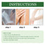 Psoriasis Cream, Relieve Itchy Skin Of Hands And Feet Skin Moss Body Skin Care Cream - Korvel