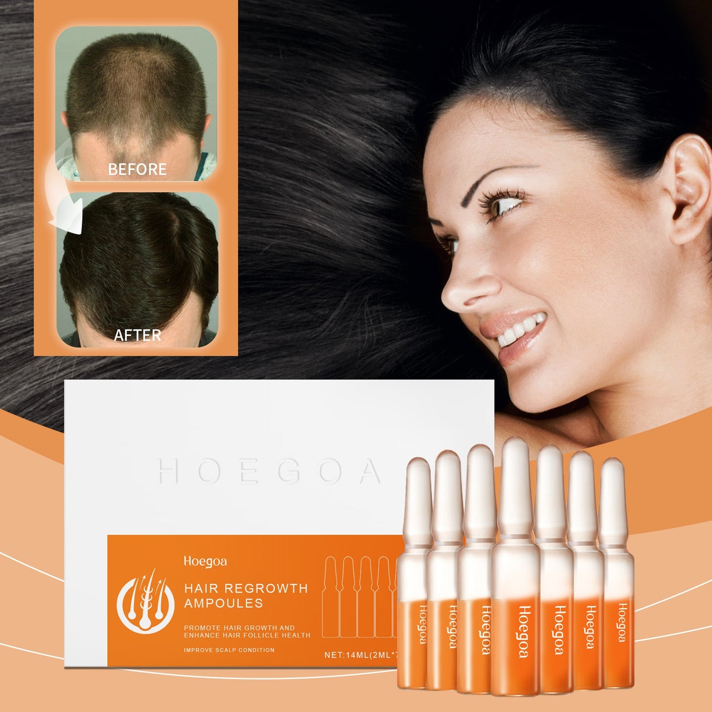 Hair Regrowth Ampoules, Nourish The Scalp To Promote Germinal Nourish Hair Follicle Health Care Essence - Korvel