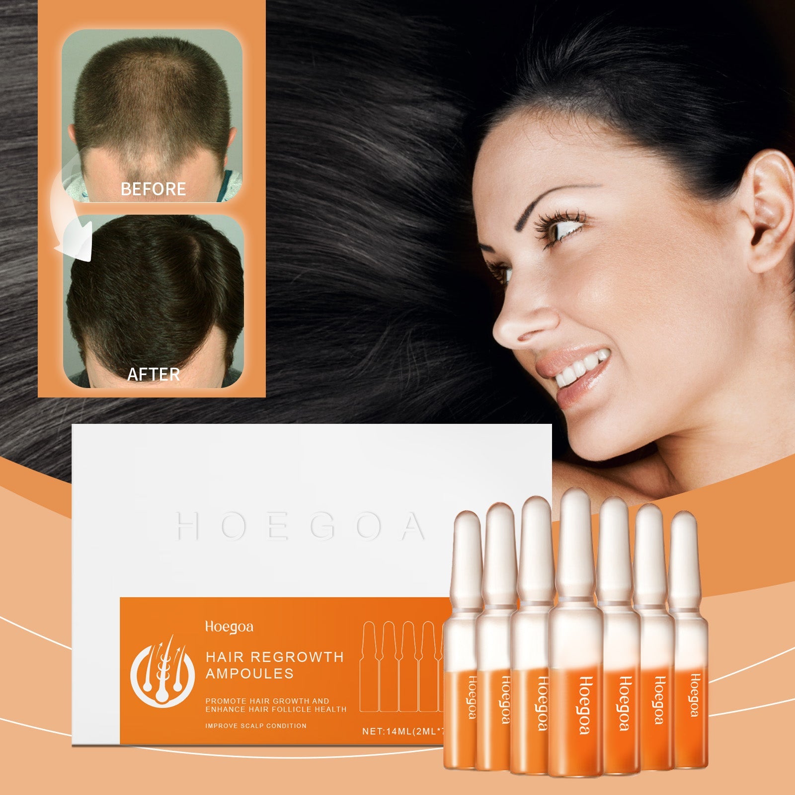 Hair Regrowth Ampoules, Nourish The Scalp To Promote Germinal Nourish Hair Follicle Health Care Essence - Korvel