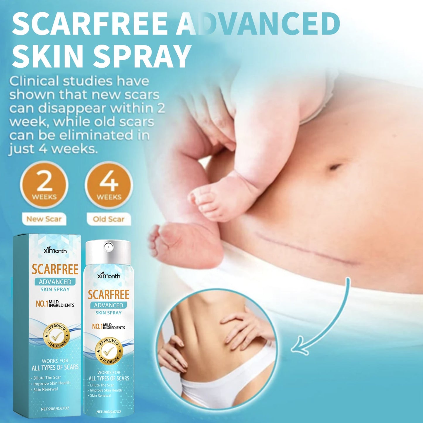 Scarfree Advanced Skin Spray, Body Skin Care Reduces Post-Natal Scars And Smooths Skin - Korvel