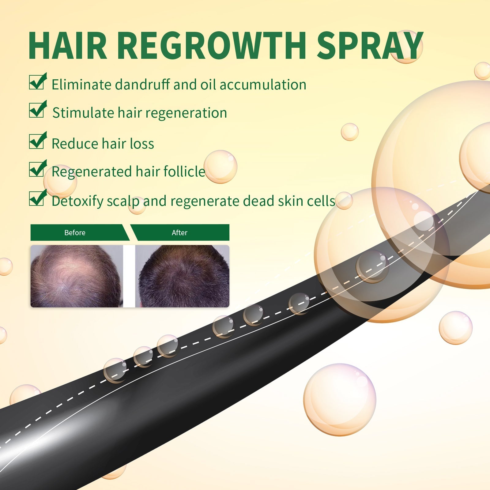 Hair Growth Spray, Thickening Preventing Loss And Repairing Hair Follicle Damage Dry And Frizzy Hair Spray - Korvel