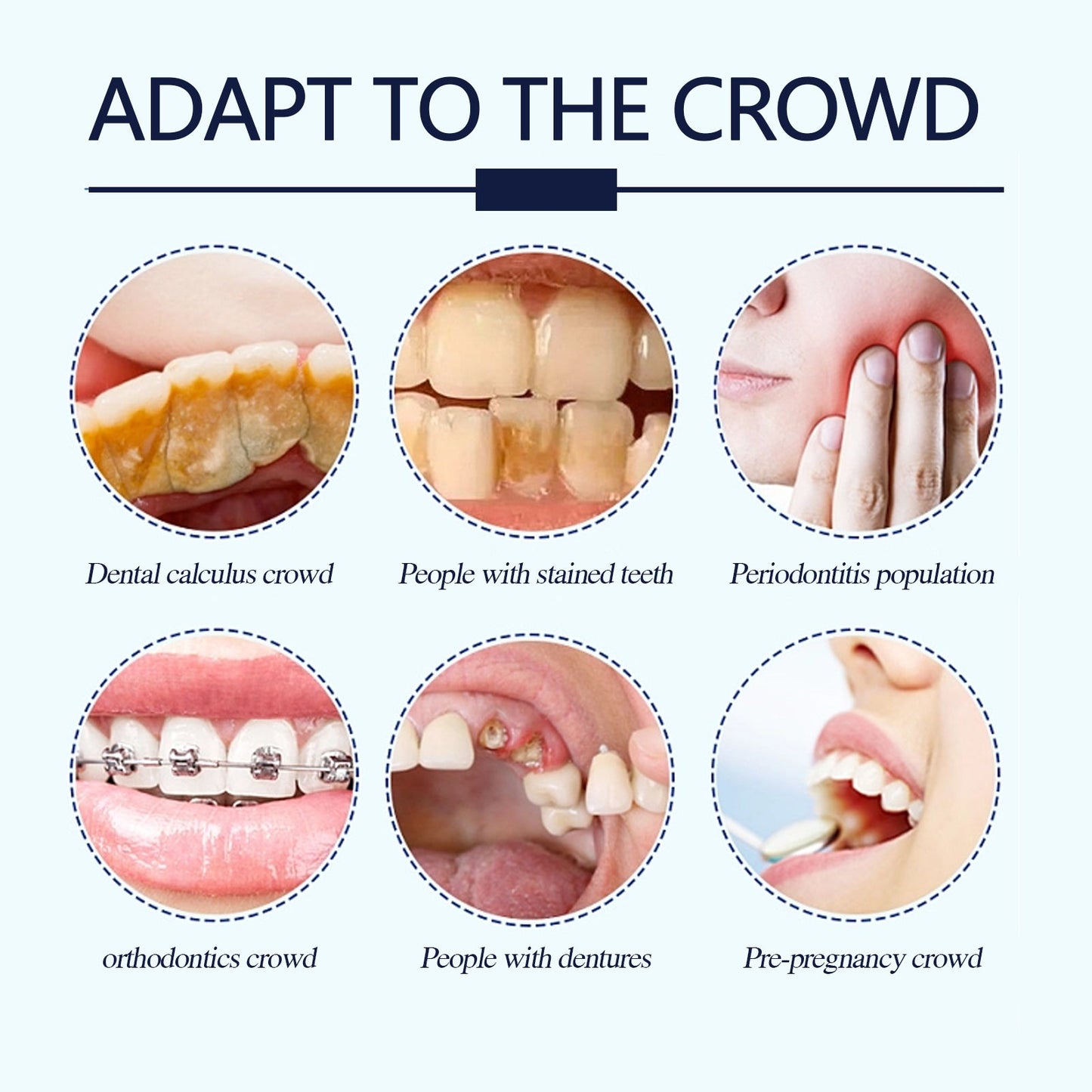 White Tooth Powder, Teeth Cleaning Brightening White Fresh Mouth Beauty Powder - Korvel