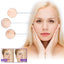 Facial Wrinkle Patch, Droop Decree Line Lift Facial Skin Tightens Mouth Line Cheek Patch - Korvel