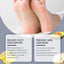 Nourishing Foot Cream Moisturizing And Hydrating Feet Soothing Dry Repair Nourishing Foot Cream - Korvel
