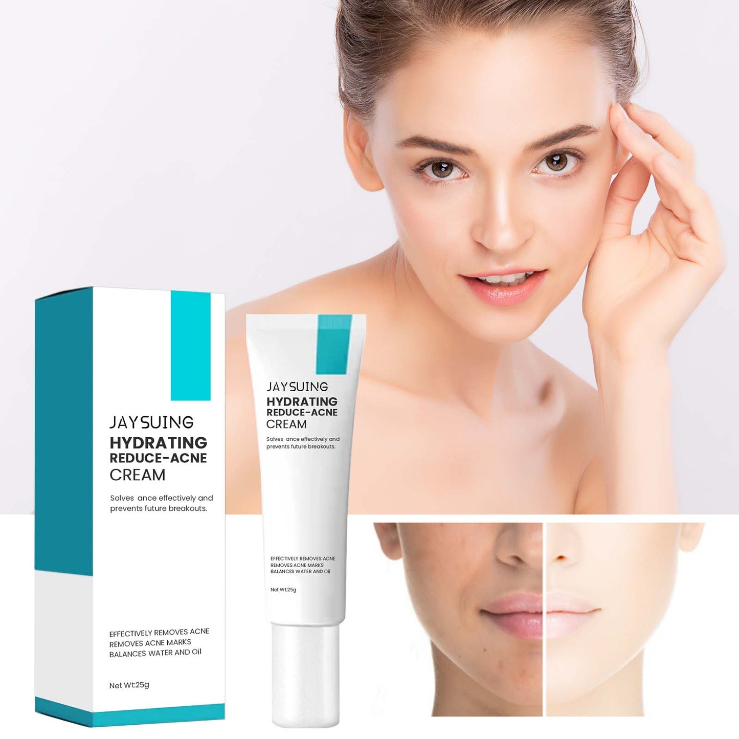 Brightening Anti-Acne Cream, Lighten Acne Pimples, Shrink Pores, Moisturize Skin Brightening Cream - Korvel