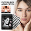 Patch anti-acné noir mignon JAYSUING pour soins de la peau