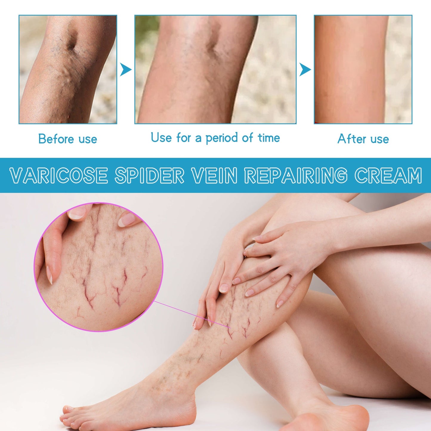 Varicose Spider Vein Repairing Cream, Relief Leg Pain Earthworm Leg Veins Care Massage Cream - Korvel