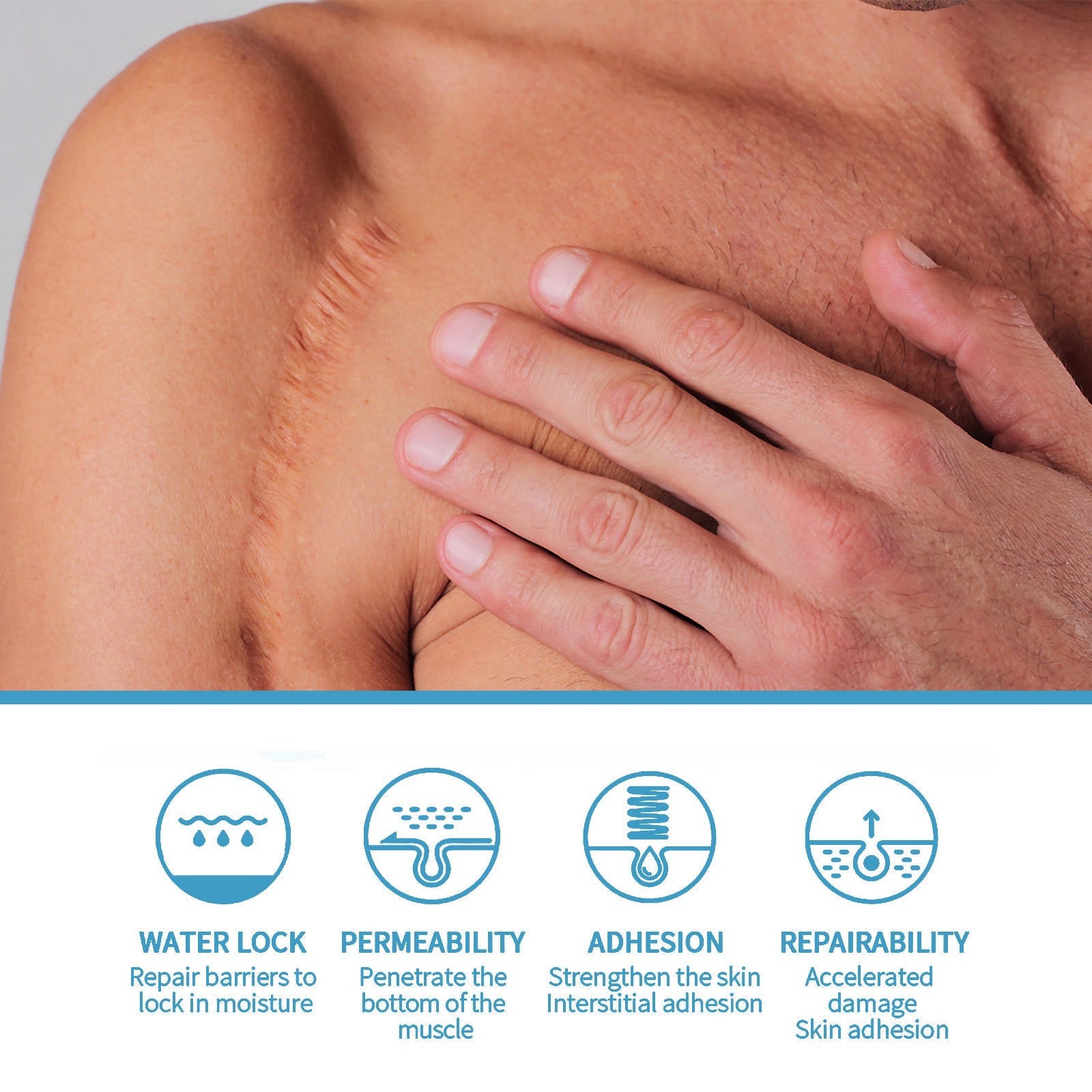 Scar Repair Serum Lightens Post-Pregnancy Scar Repair And Smoothes Body Skin - Korvel