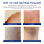 Body Whitening Cream, Lightening Dull Skin Even Skin Tone Moisturizing Skin Beauty Cream - Korvel