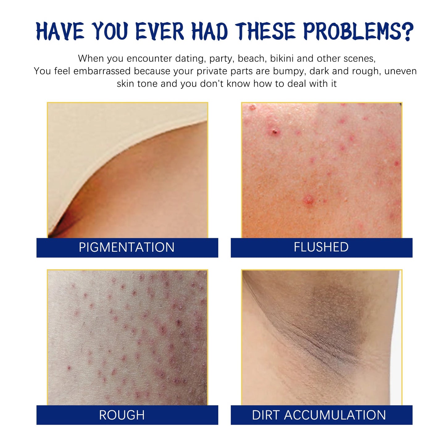 Body Whitening Cream, Lightening Dull Skin Even Skin Tone Moisturizing Skin Beauty Cream - Korvel