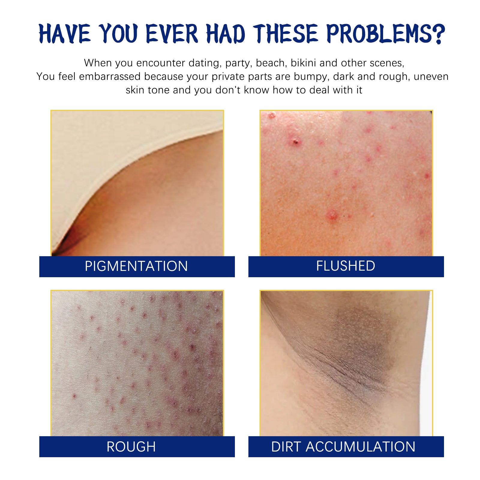 Body Whitening Cream, Lightening Dull Skin Even Skin Tone Moisturizing Skin Beauty Cream - Korvel
