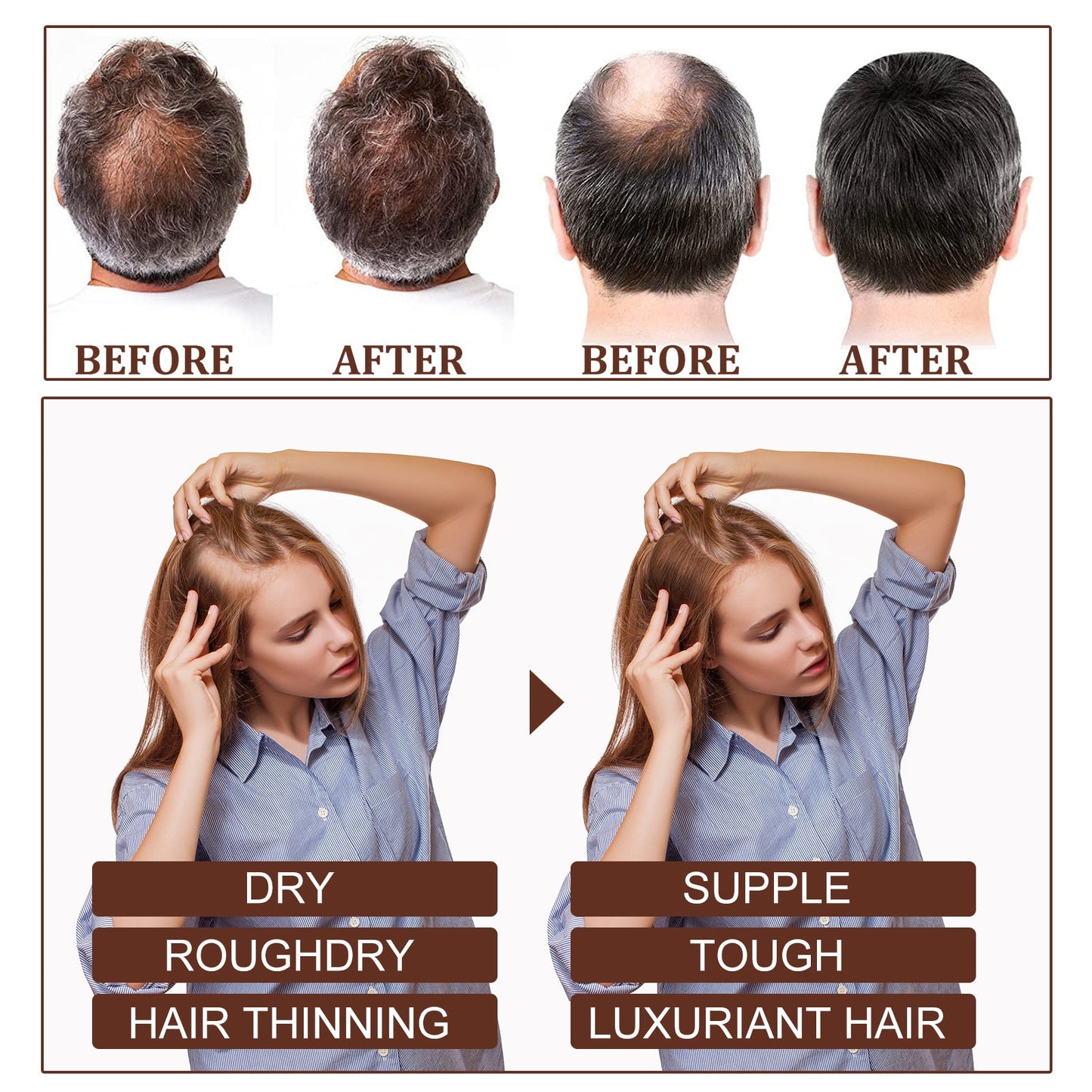 Castor Oil Hair Dense Essential Oil Repair Damaged Hair, Nourish Scalp, Strengthen Hair And Prevent Hair Loss - Korvel