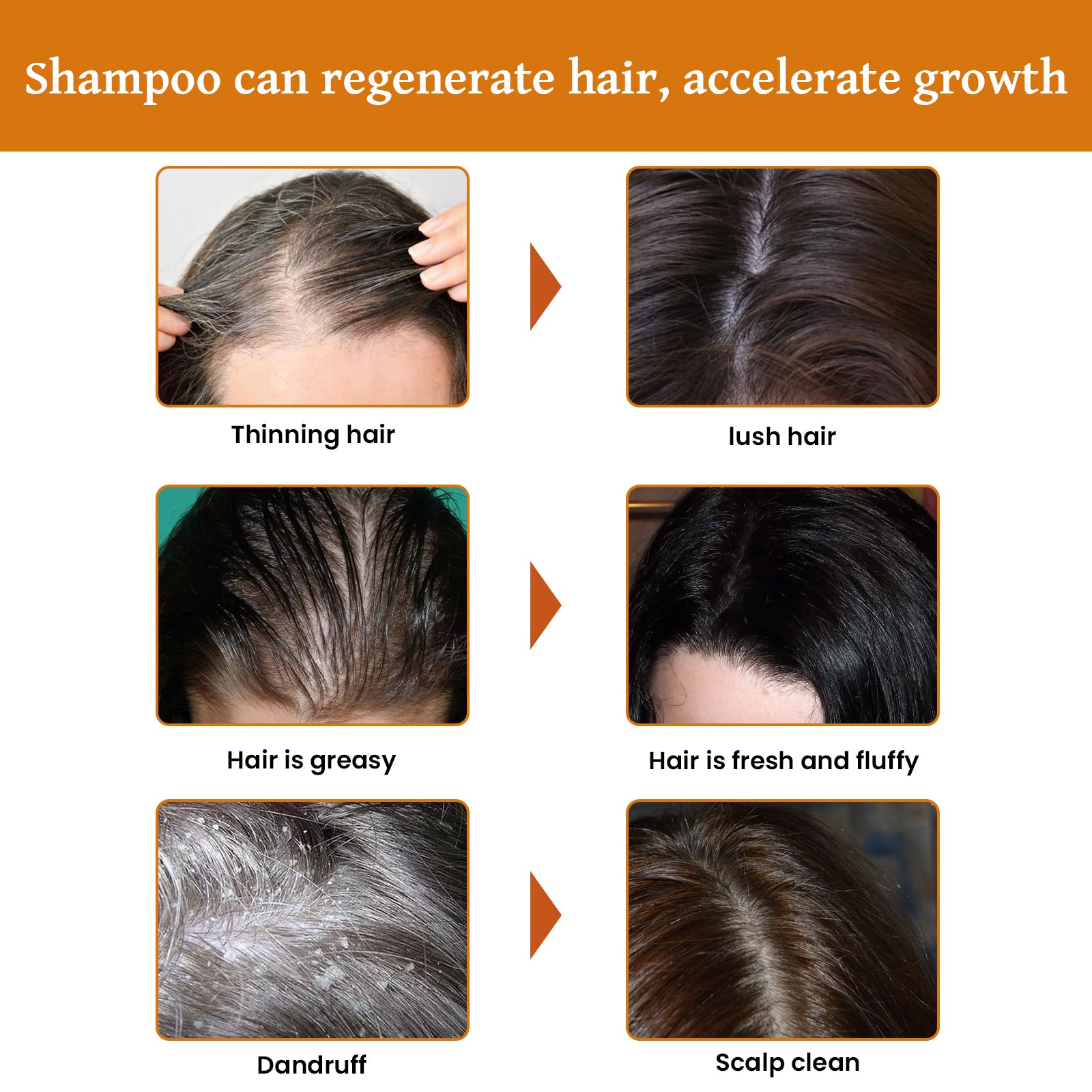 Rice Dense Hair Shampoo Deep Clean Thick Hair Moisturizing Hair Root Solid Hair Care Shampoo - Korvel