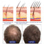 Men's Dense Hair Foam Machine, Repair Hair Root Follicle Men's Hair Thick Moisturizing Foam - Korvel