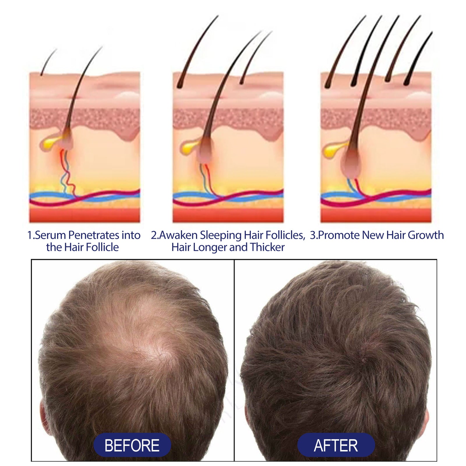 Men's Dense Hair Foam Machine, Repair Hair Root Follicle Men's Hair Thick Moisturizing Foam - Korvel