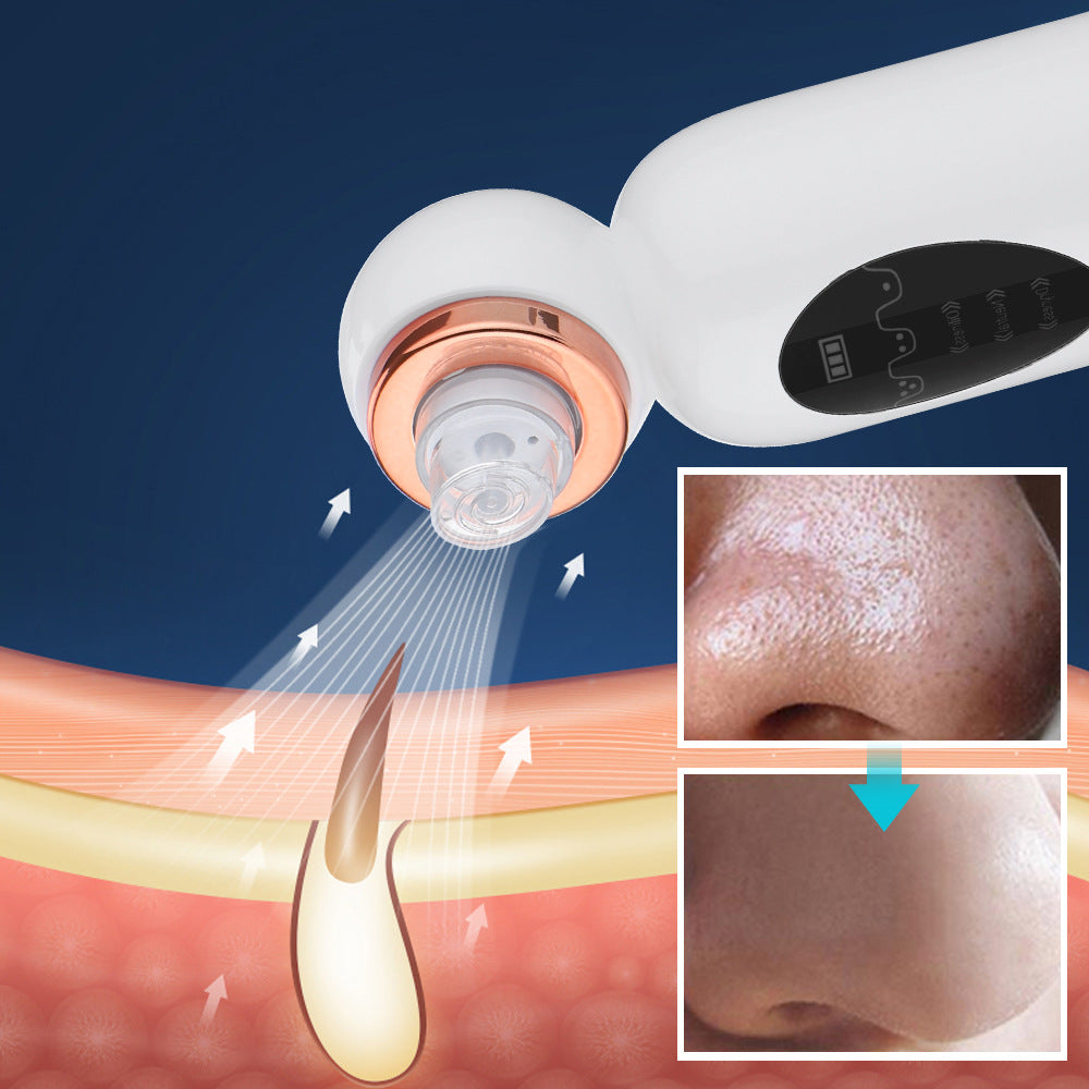 3-Speed Small Bubble Blackhead Instrument Facial Pore Cleaning To Remove Blackhead Beauty Instrument Electric Blackhead Exporter - Korvel
