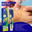 Wart Remover Ointment, Remove Hou Warts Flat Corn Plaster Flat Grains Warts, Foot And Repair Skin Dot Mole G Wart Cream - Korvel