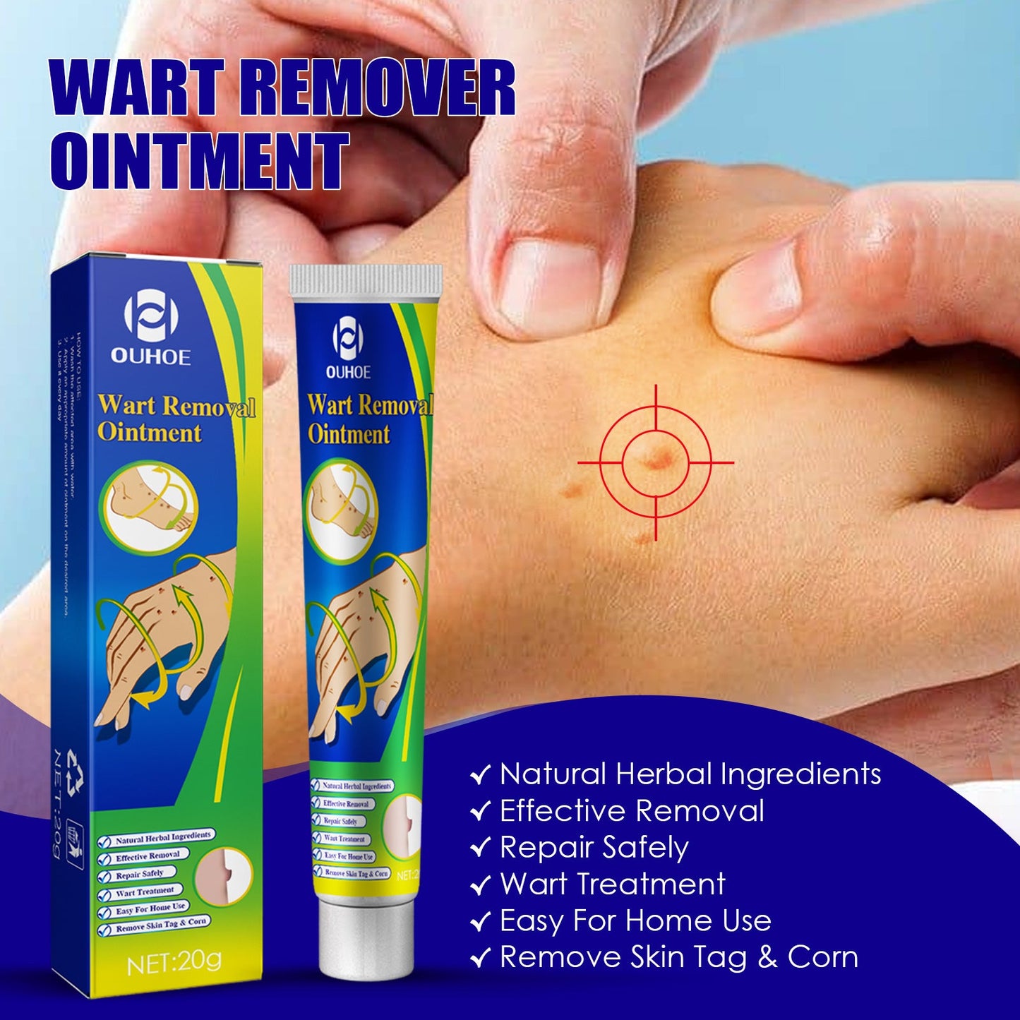 Wart Remover Ointment, Remove Hou Warts Flat Corn Plaster Flat Grains Warts, Foot And Repair Skin Dot Mole G Wart Cream - Korvel