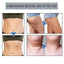 Slimming Essential Oil Nose Ring Tightens Curves And Reduces Belly Fat Shaping Essential Oil Ring Tightens Skin - Korvel