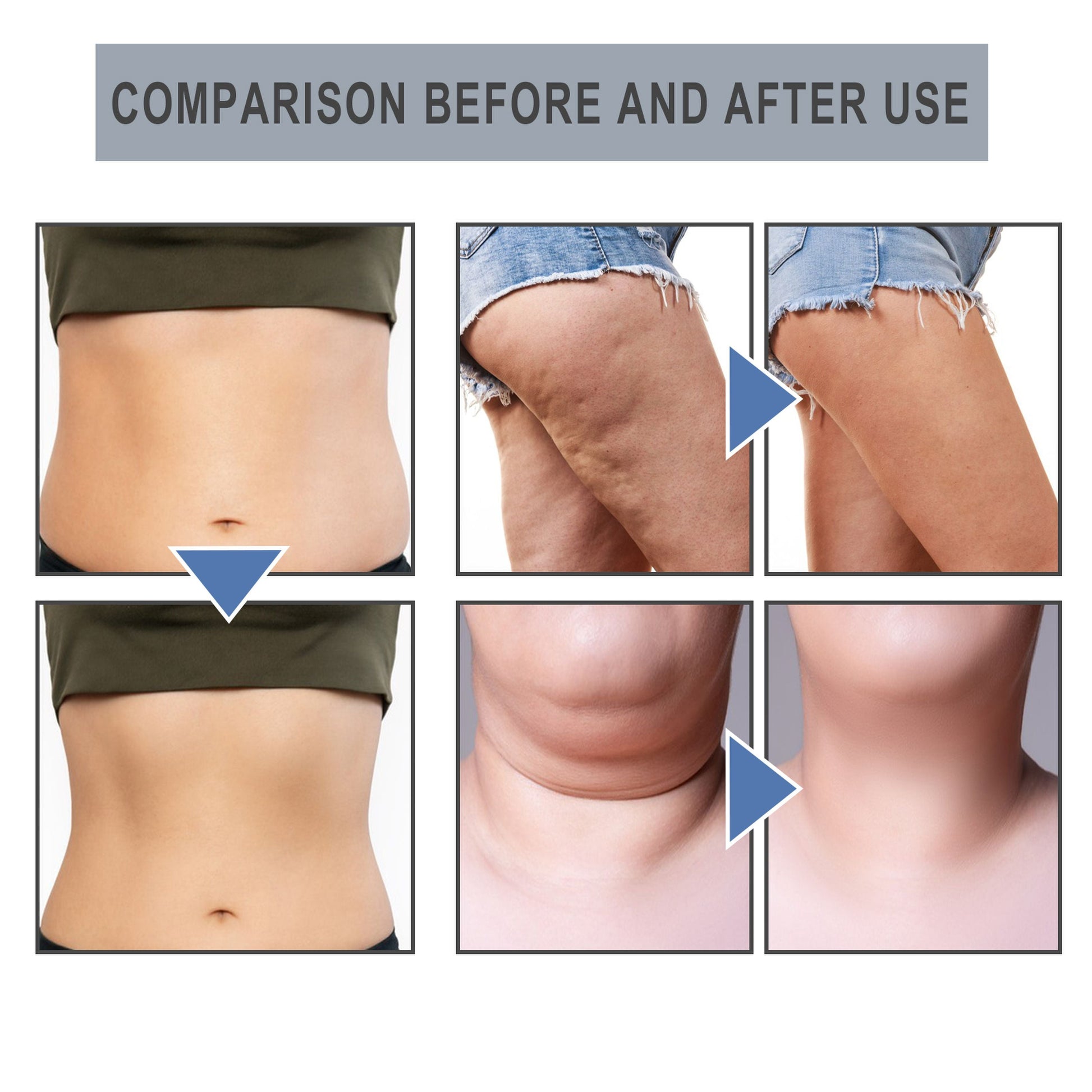 Slimming Essential Oil Nose Ring Tightens Curves And Reduces Belly Fat Shaping Essential Oil Ring Tightens Skin - Korvel