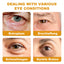 Gold Snail Eye Patch Hydrating Eye Patch Skin Care Around The Eyes - Korvel