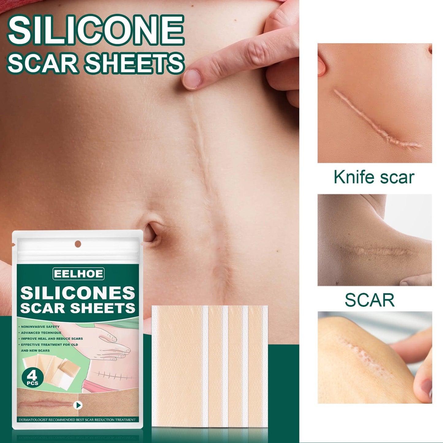 Silicone Gel Repair Patch, Fade Marks Transparent Care Skin Repair Patch - Korvel