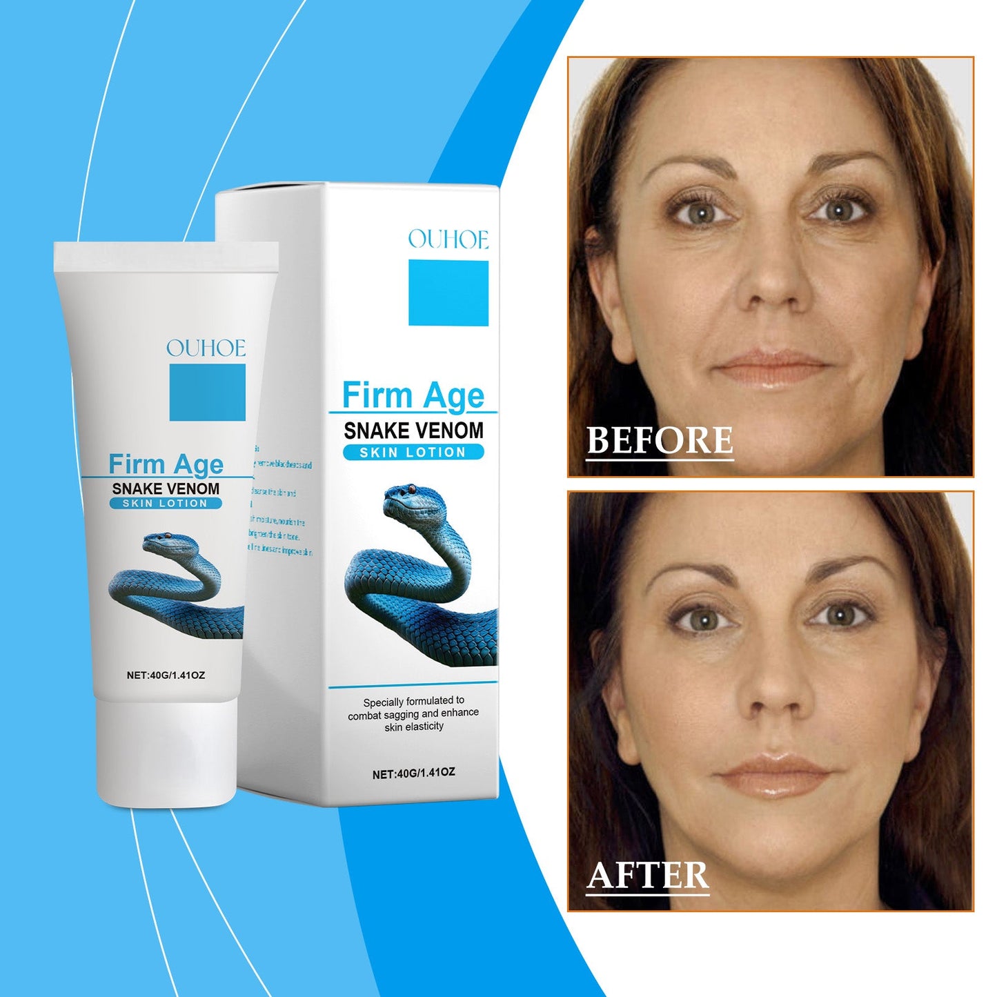 Body Care Cream Moisturizes, Improves Skin Elasticity, Moisturizes Skin And Anti-Wrinkle Skin Care Body Cream - Korvel