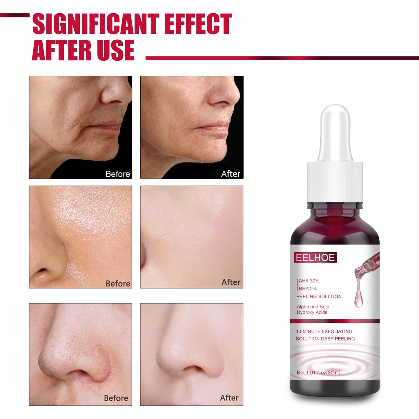 AHA 30% + BHA 2% Exfoliating Essence for Pore Refinement