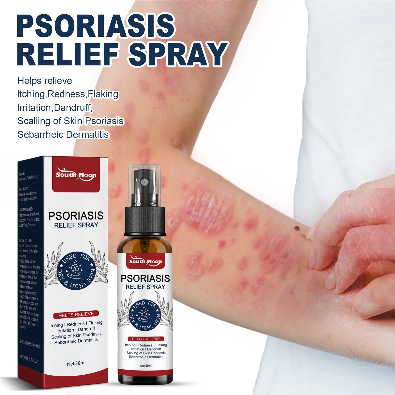 Psoriasis Relief Spray, Relieve Skin, Hands And Feet Redness Peeling Itch Repair External Care - Korvel