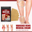 Aricose Veins Medical Cream, Relieve Leg Swelling Earthworm Leg Vein Massage To Relieve Pain - Korvel